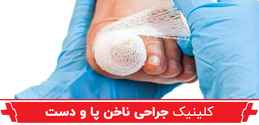 جراحی ناخن پا